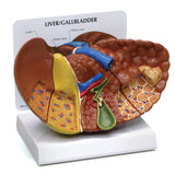 Liver Model with Common Pathologies