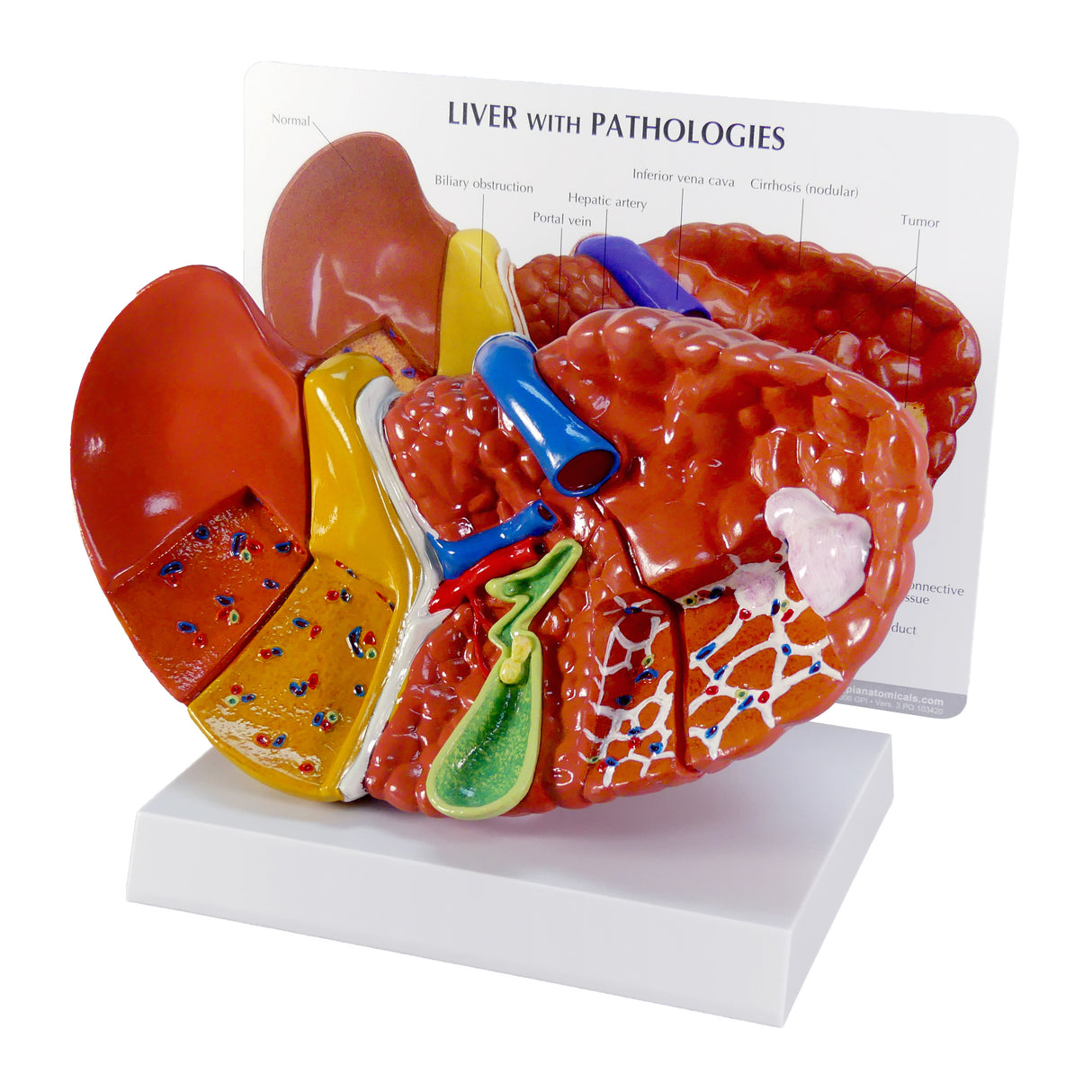 Liver Model with Common Pathologies