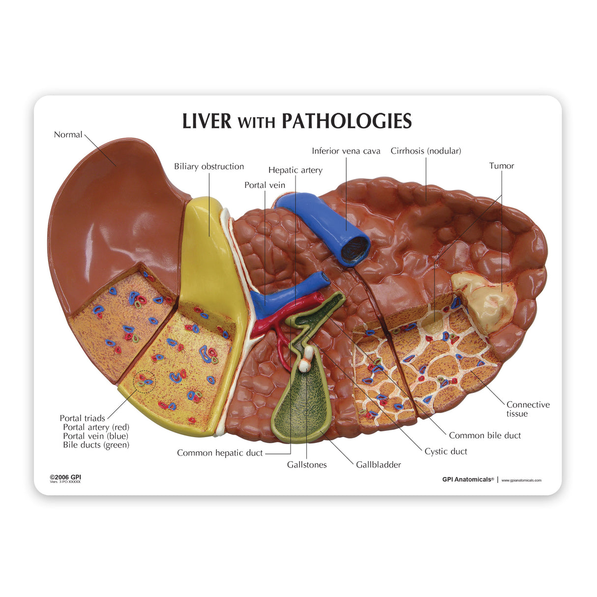 Liver Model with Common Pathologies