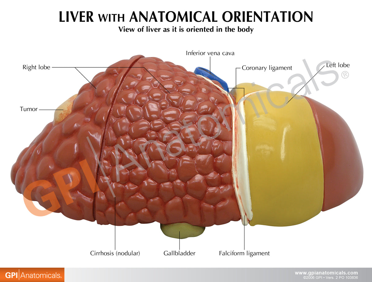 Liver Cancer Education Card