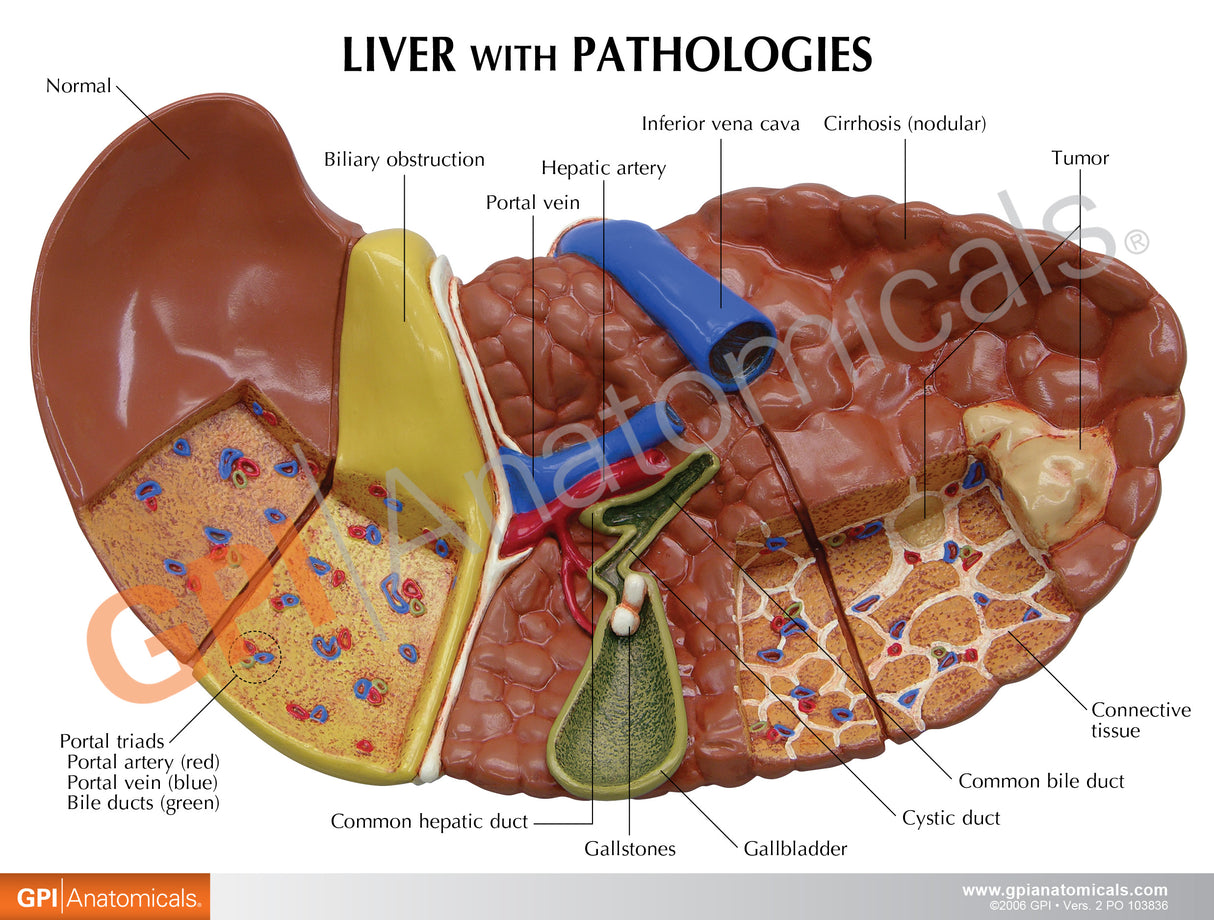 Liver Cancer Education Card