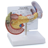 Pancreas with Gallbladder and Spleen Model