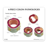 4-Piece Colon Set Education Card