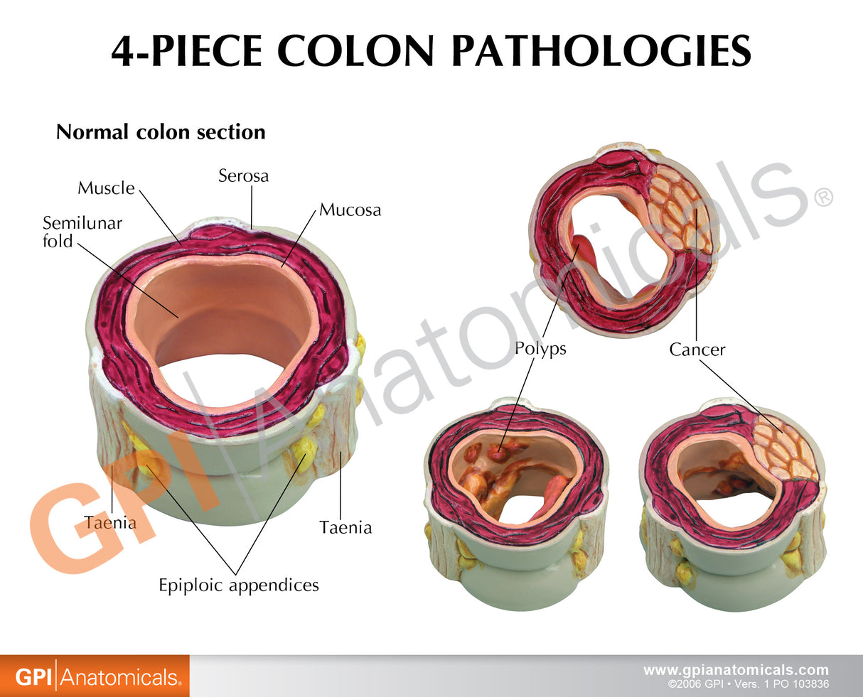 4-Piece Colon Set Education Card