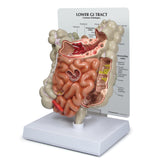 GI Tract Model with Common Pathologies