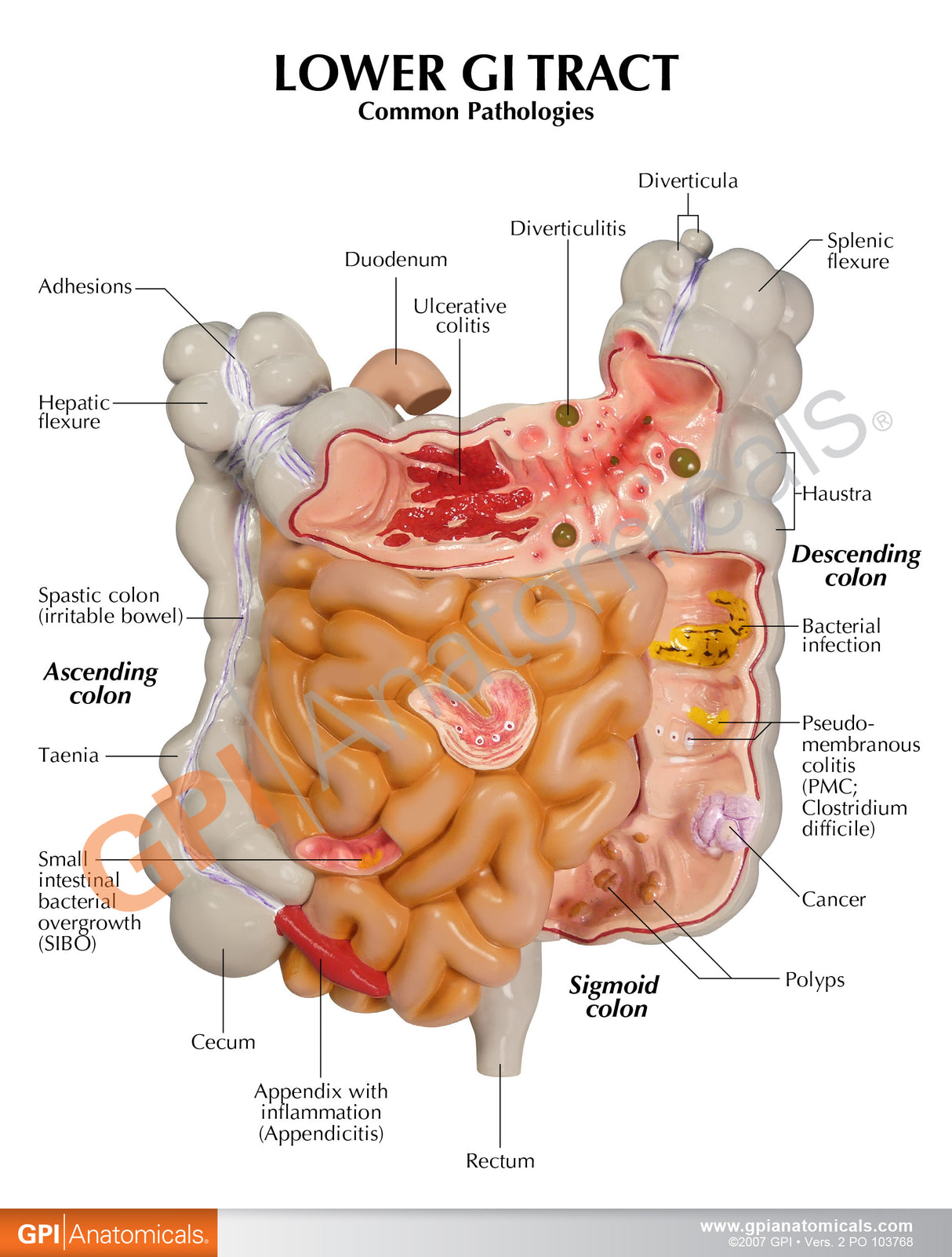 GI Tract Education Card