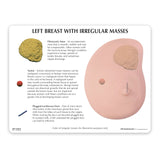 Left Breast Education Card