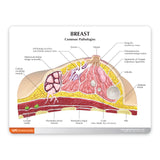 Breast Cross-Section Model