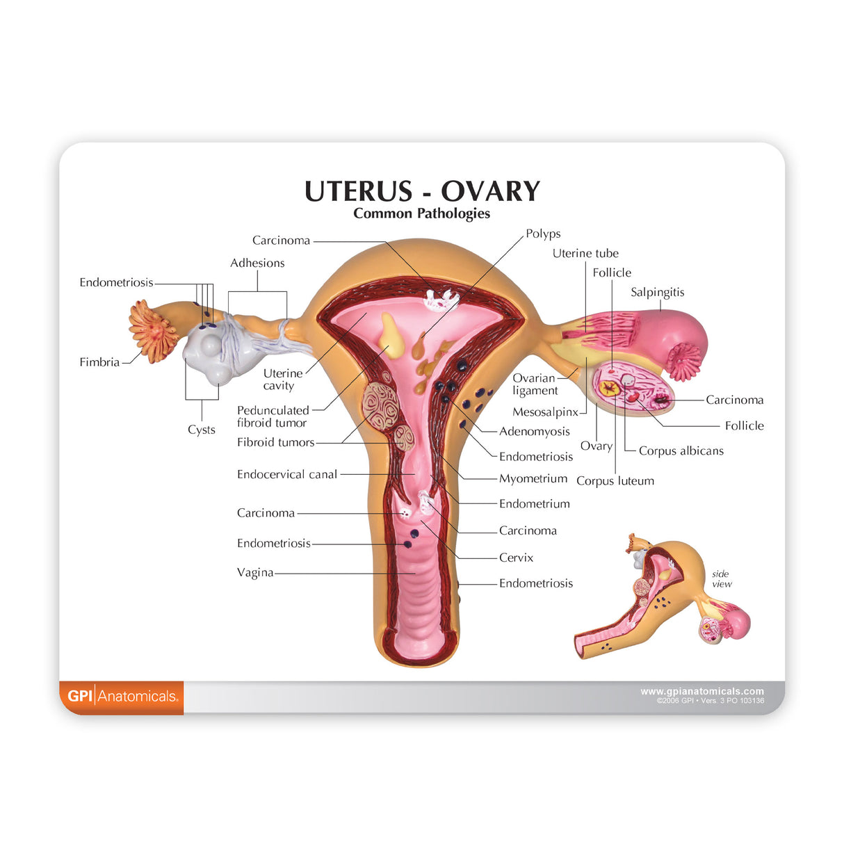 Uterus and Ovary Model