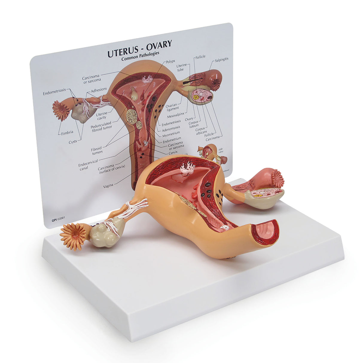 Uterus and Ovary Model