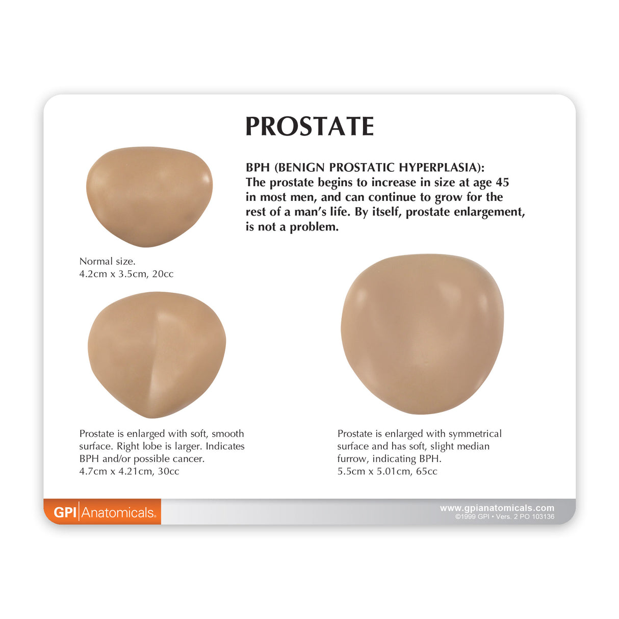 Male Pelvis with Prostate Education Card