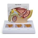 Male Pelvis Model with 3D Prostate Frame