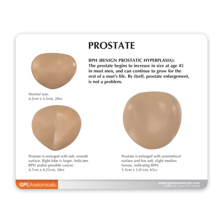 Male Pelvis Model with 3D Prostate Frame