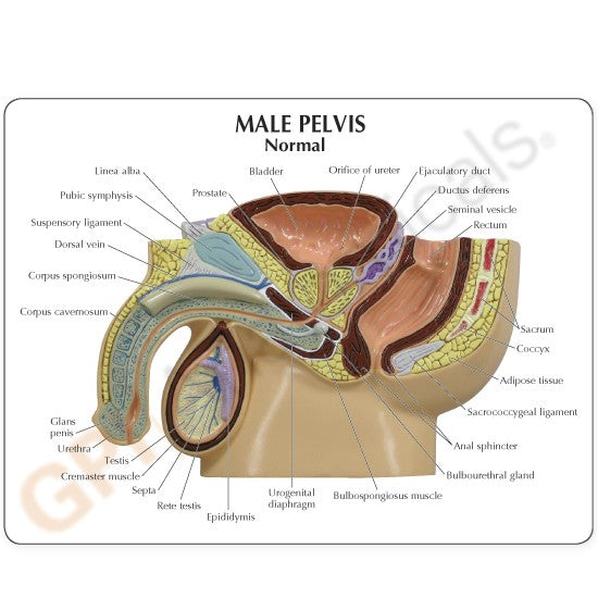 Male Pelvis with BPH Education Card