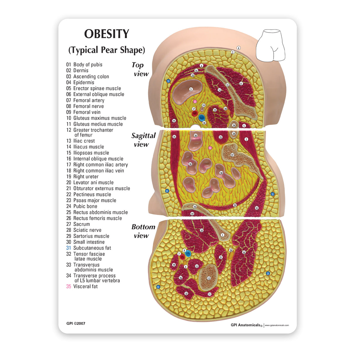 Obesity Model