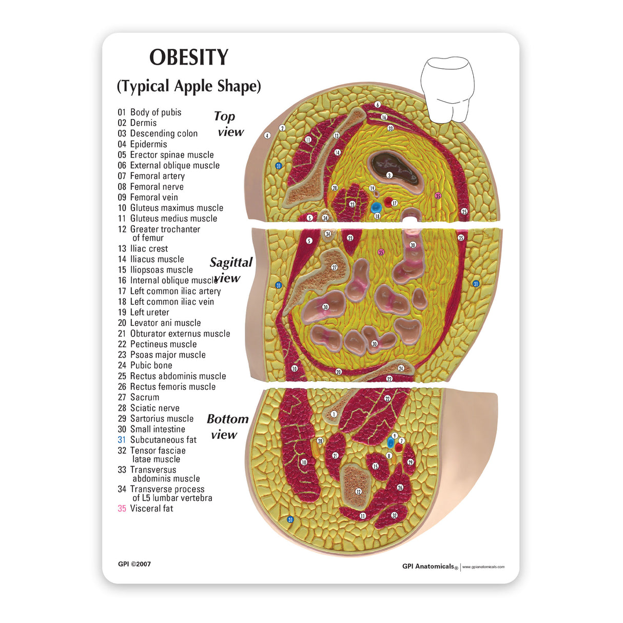 Obesity Education Card