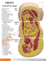 Obesity Model