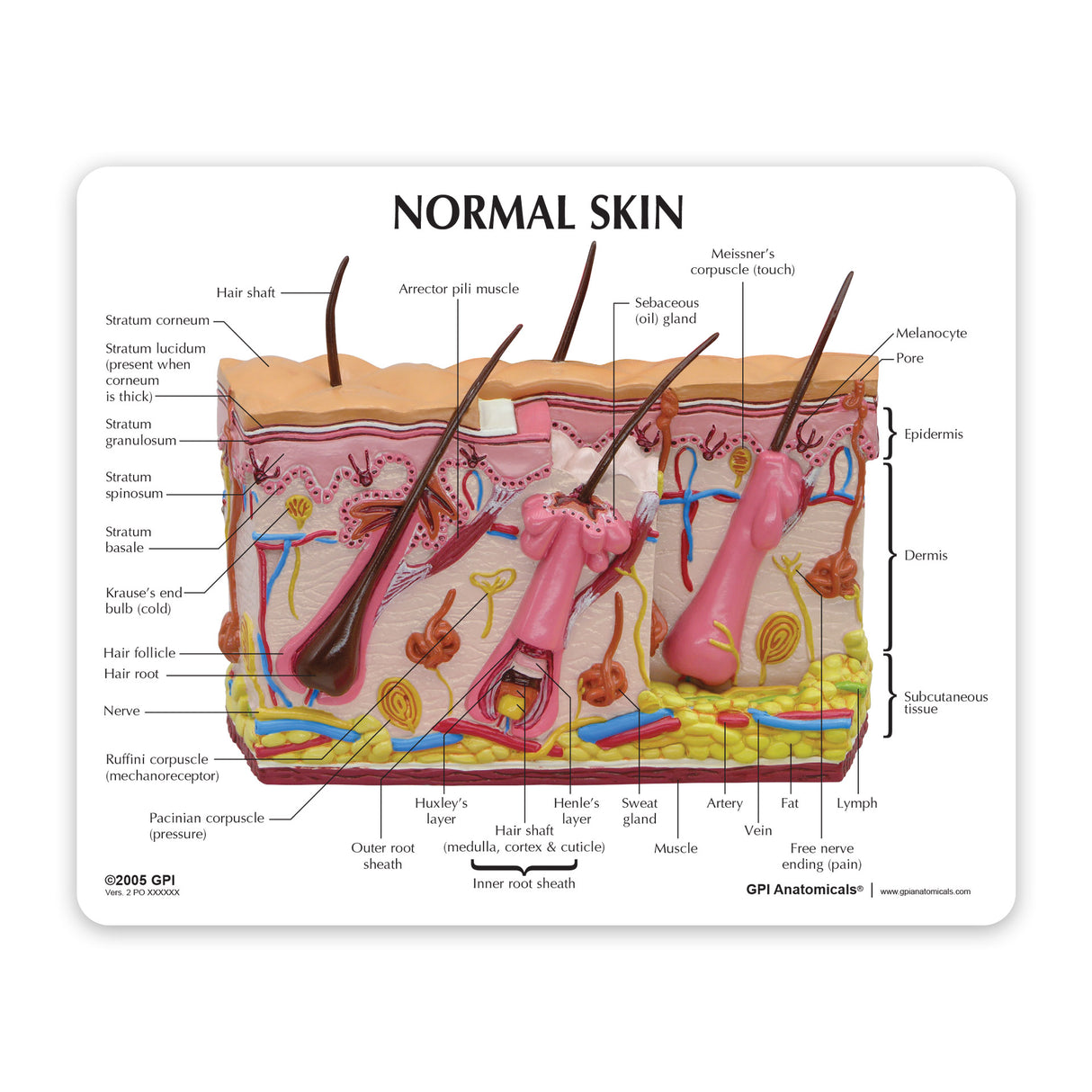 Skin Acne Cross-Section Model