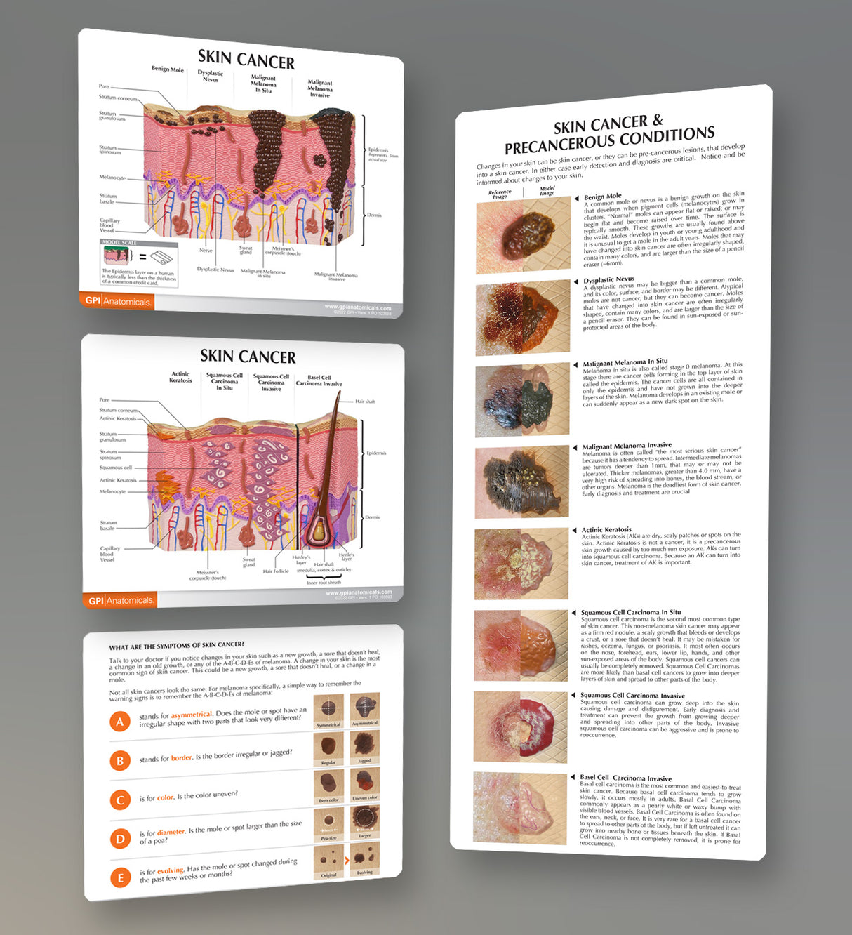 Melanoma Skin Cancer Education Card