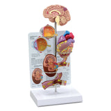 Hypertension Model Set