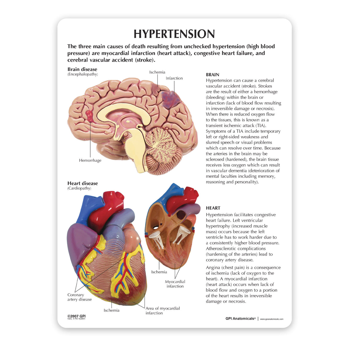 Hypertension Model Set