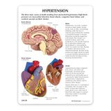 Hypertension Set Education Card