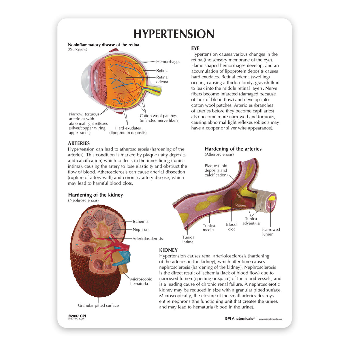 Hypertension Model Set