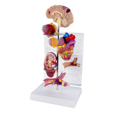 Hypertension Model Set