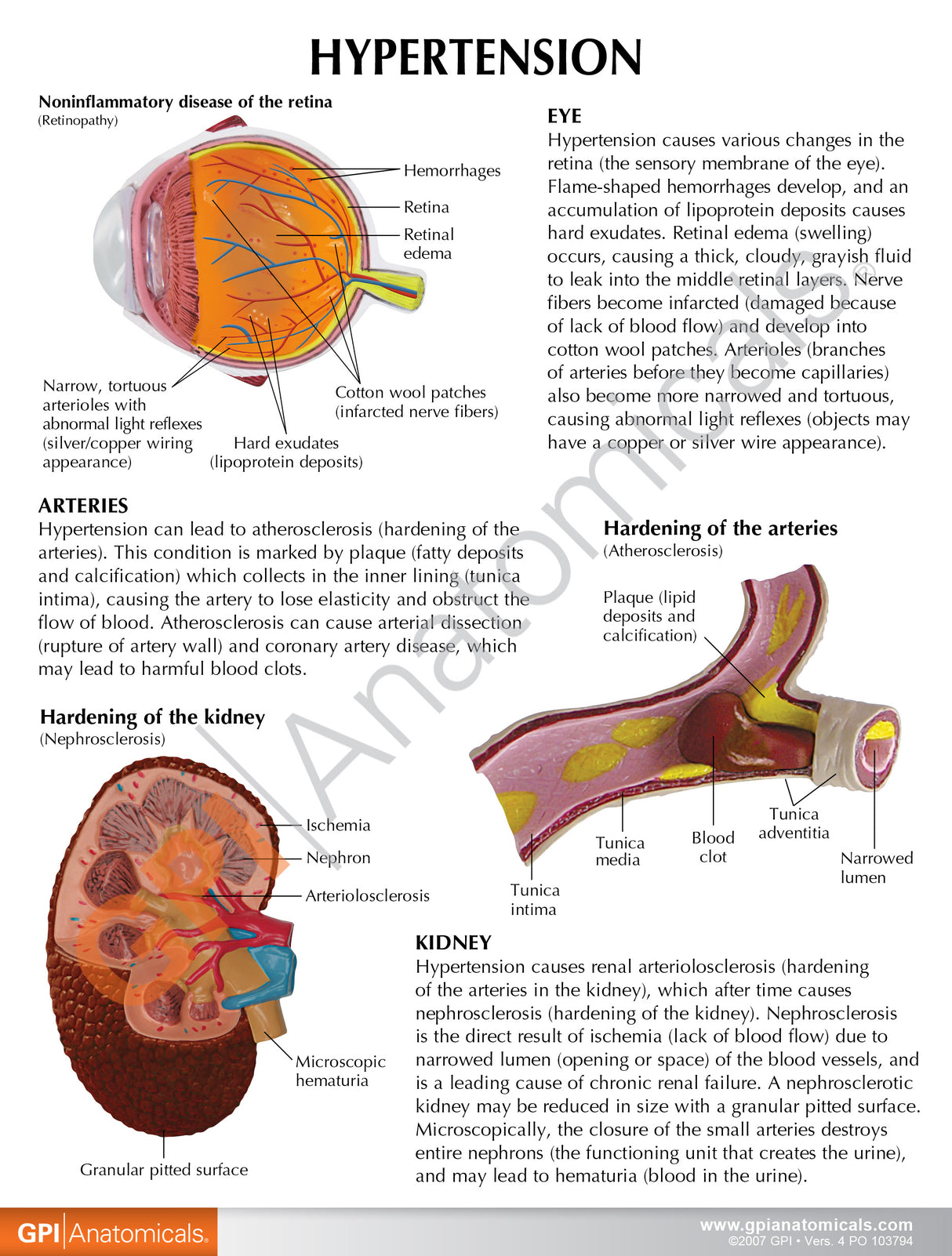 Hypertension Set Education Card