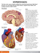 Hypertension Set Education Card