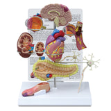 Type II Diabetes Model Set