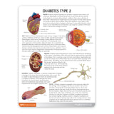 Type II Diabetes Model Set