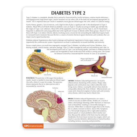 Type II Diabetes Set Education Card