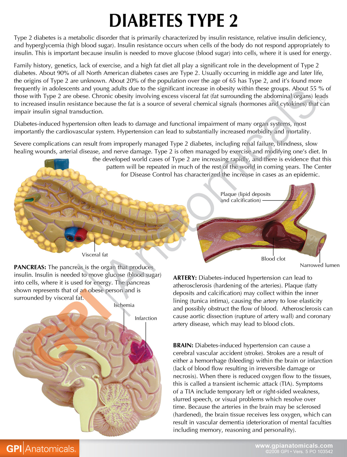 Type II Diabetes Set Education Card