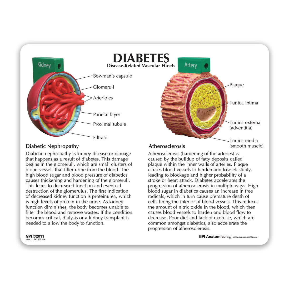 4-Piece Diabetes Education Card