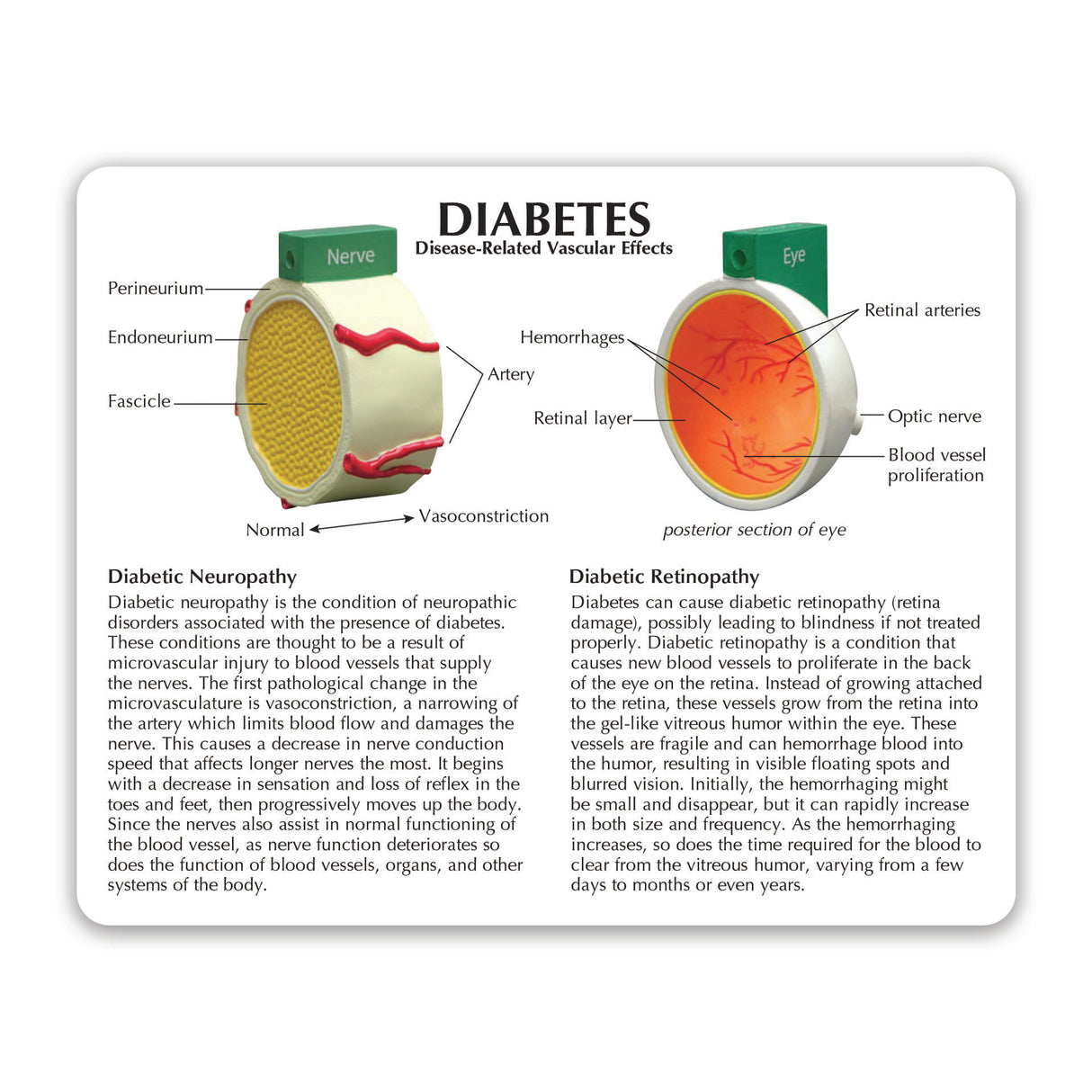 4-Piece Diabetes Education Card