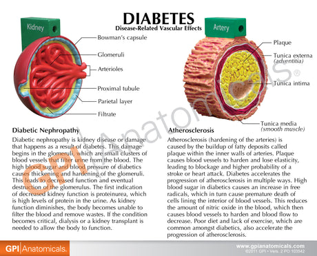 4-Piece Diabetes Education Card