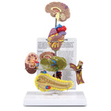 Metabolic Syndrome Model Set