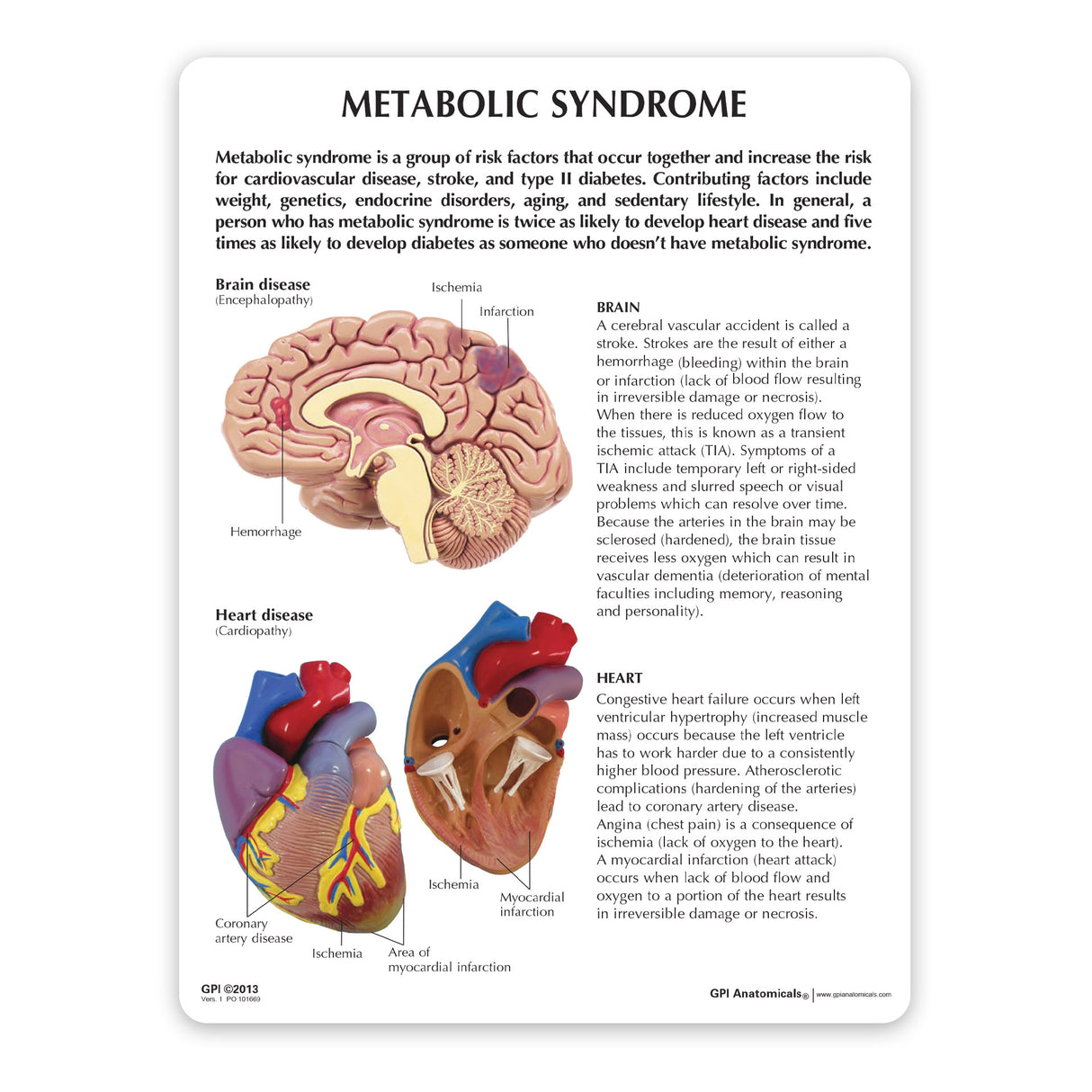 Metabolic Syndrome Model Set