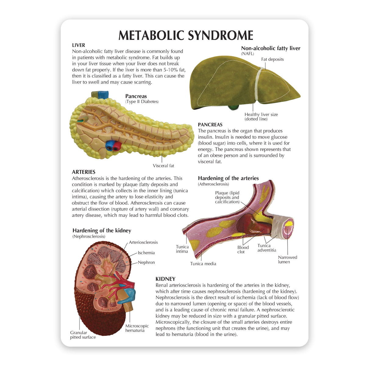 Metabolic Syndrome Education Card