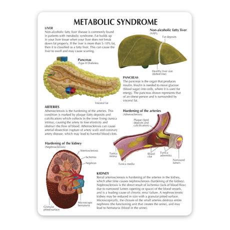 Metabolic Syndrome Model Set