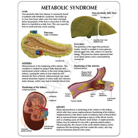 Metabolic Syndrome Model Set