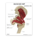 Muscled Hip Education Card