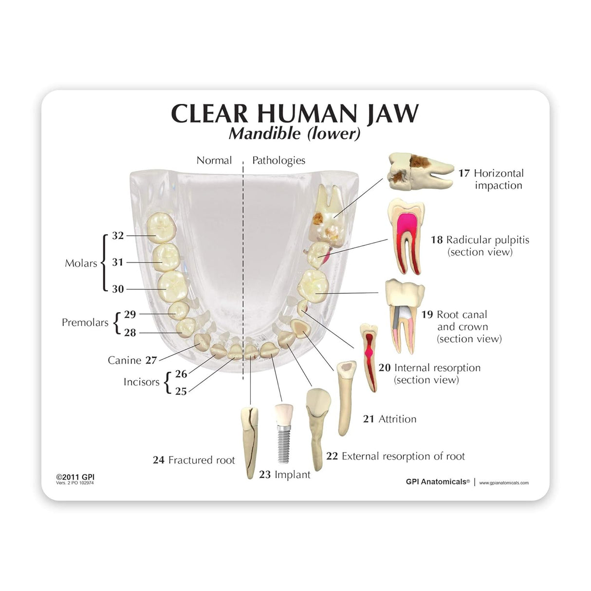 Teeth Model, Clear