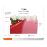 Teeth Education Card