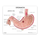 Stomach Model with Ulcers