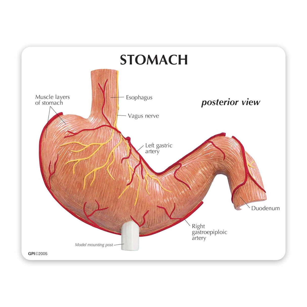 Stomach Model with Ulcers