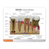 Teeth Education Card