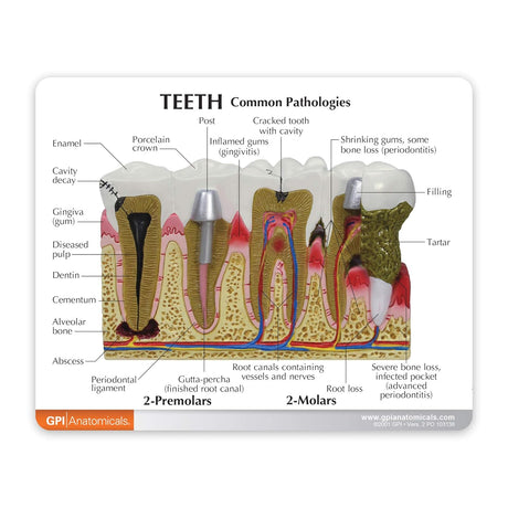 Teeth Model