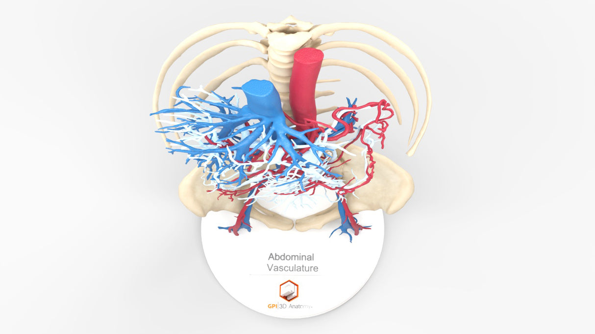 Abdominal Vasculature - Female, 53